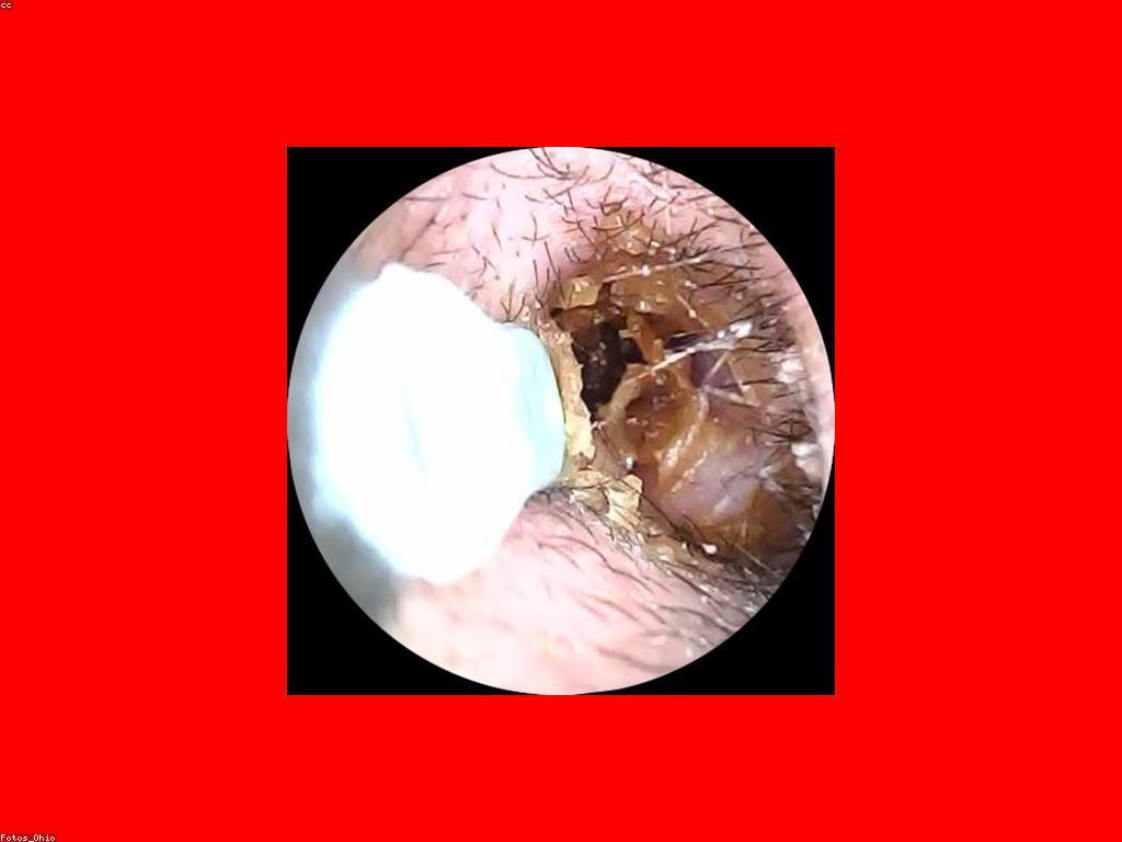 ហ្គេមសំរាប់អ្នកពេញនិយម: អ្វីដែលអ្នកត្រូវដឹង